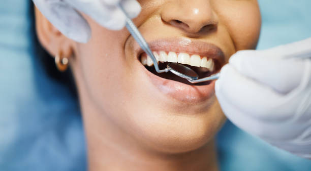 Best Emergency Root Canal Treatment in Fredericksburg, TX