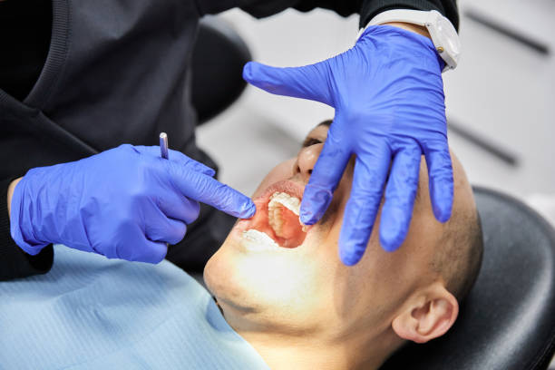 Best Emergency Dental Care for Broken or Chipped Teeth in Fredericksburg, TX